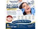 Natural-Looking Tooth Colored Fillings in Homeland - Dr. Tejas Modi