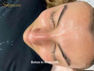 Botox in Riverside for a Refreshed and Youthful Appearance