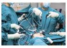 Best Laparoscopic Surgeon in Kolkata for Advanced Surgery