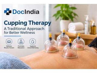 Find the Best Cupping Therapy in Delhi – Book Online | DocIndia