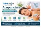 Acupuncture in Culver City, CA | Personalized Acupuncture Care