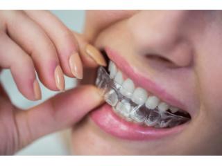 Discover a Confident Smile with In****lign Richmond VA