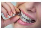 Discover a Confident Smile with Invisalign Richmond VA