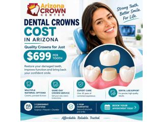 Dental Crowns Cost in Arizona – Quality Crowns for Just $699