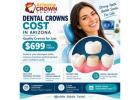 Dental Crowns Cost in Arizona – Quality Crowns for Just $699