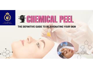 Advanced Chemical Face Peel Services in Thane | DNA Royal