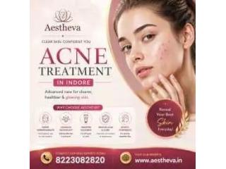 Acne Treatment in Indore - Aestheva