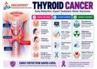 Thyroid Cancer Doctor in Mumbai | Dr. Sanket Shah