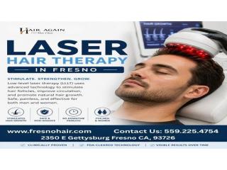 laser hair therapy Fresno