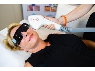 Alpha Laser Hair Removal Machine | Dermaspark