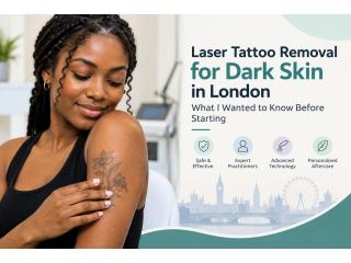 Your Tattoo Removal Questions Deserve Real Answers Before You Begin
