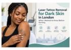 Your Tattoo Removal Questions Deserve Real Answers Before You Begin