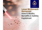 Best Laser Birthmark Removal in Thane – DNA Royal.