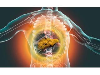 Advanced Cirrhosis Management in Ahmedabad – Dr. Jigar Patel
