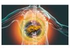 Advanced Cirrhosis Management in Ahmedabad – Dr. Jigar Patel