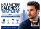 How Does Male Pattern Baldness Treatment in NYC Work?