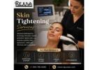 Skin Tightening Services Newport Beach: What to Know