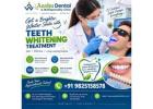 Expert Teeth Whitening Treatment for Yellow & Stained Teeth