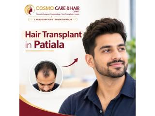 Hair Transplant in Patiala – Explore Hair Restoration with Cosmo Care & Hair Clinic