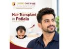 Hair Transplant in Patiala – Explore Hair Restoration with Cosmo Care & Hair Clinic