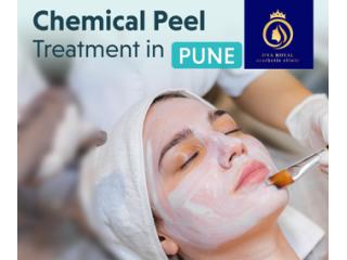 Looking for Face Peeling Treatment in Thane? Choose DNA Royal.