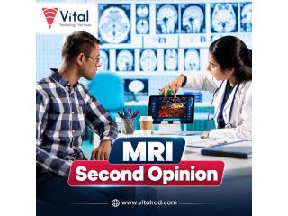 Reliable MRI Second Opinion Services in India
