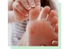 Podiatrist Ingrown South Amboy