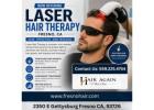 laser hair therapy Fresno